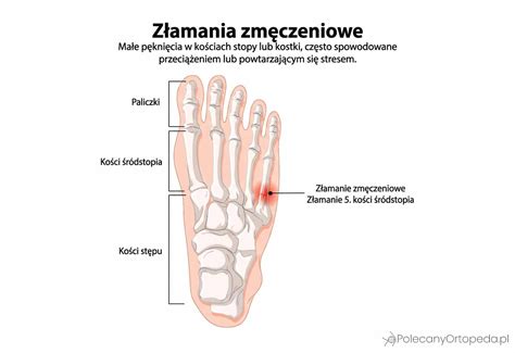 Przekrój stopy ubijaka wibracyjnego z zaznaczonymi punktami smarowania