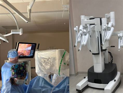 Schemat budowy robota chirurgicznego da Vinci z zaznaczeniem konsoli, wózka wizyjnego i ramion operacyjnych