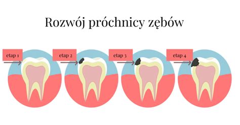 Różne stopnie zużycia zębów łyżki