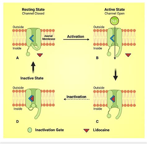 Diagram illustrating the mechanism of action of lidocaine